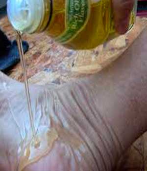 aceite-de-oliva-talones-agrietados