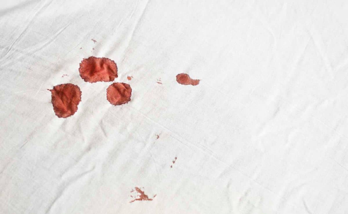 fragmento Retorcido Confidencial Manchas de sangre en las sábanas? Eliminalas con fáciles trucos