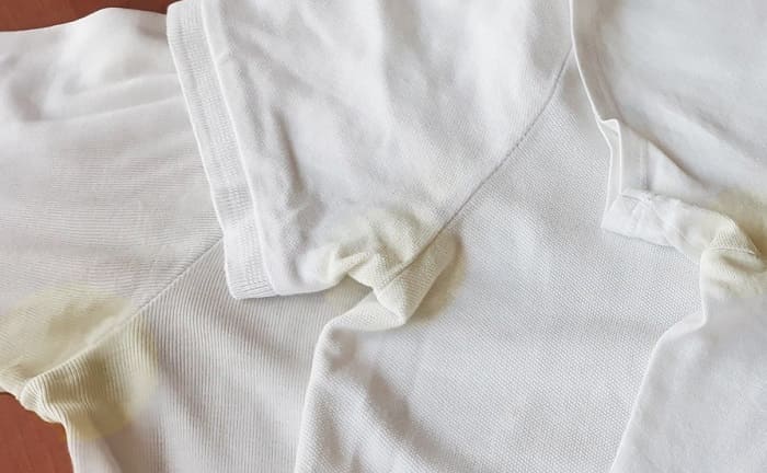 remove deodorant stains from white clothes