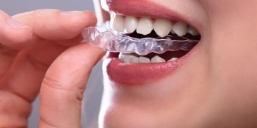 como limpiar desinfectar ferula dental
